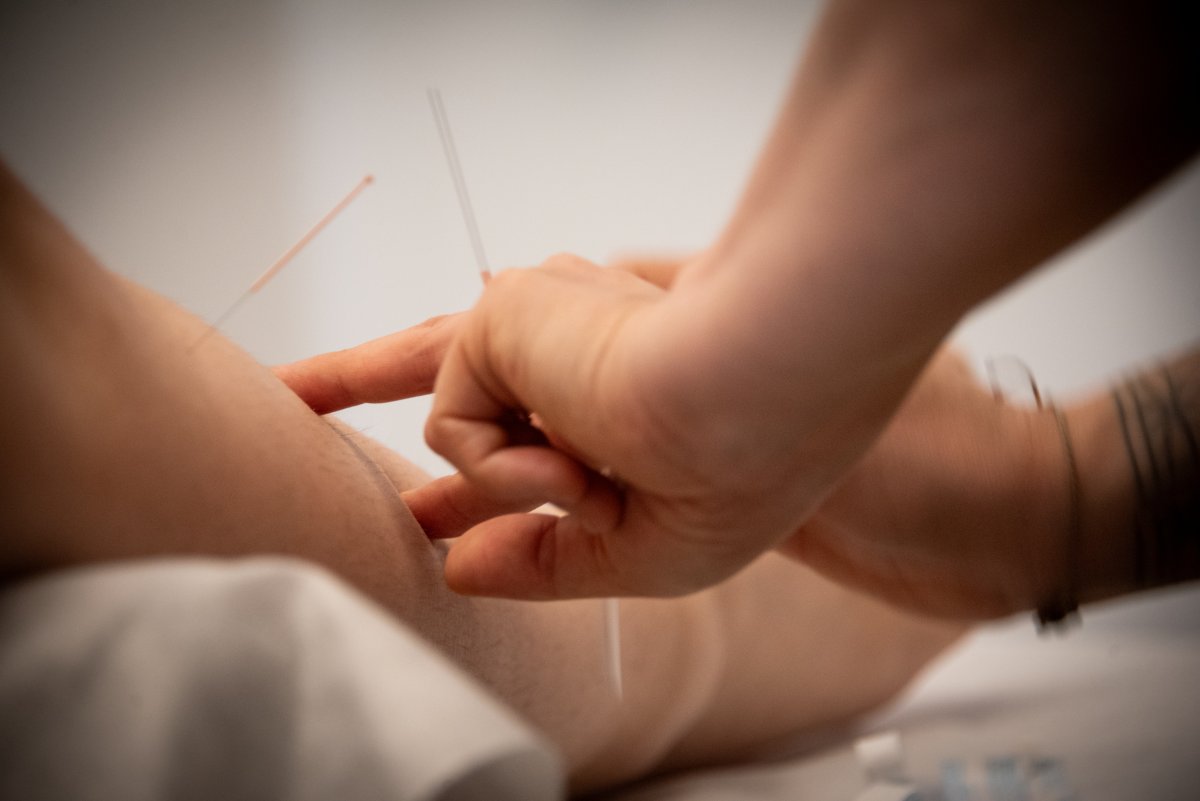 Médecine traditionnelle chinoise, MTC, acupuncture, moxibustion, ventouses, reconnu ASCA / RME, accompagnement santé global et centré sur la personne, santé holistique, Le Mont-sur-Lausanne, Lausanne Justine Clément, Acupuncture, acupuncteur, acupunctrice, Médecine traditionelle chinoise, Physiothérapie, Physiothérapeute, Rééducation, psycho-somatique, exercices somatiques, neuroatypie, Le Mont-sur-Lausanne, Mont sur Lausanne, Le Mont, Physio, holistique, santé, traitement, thérapie, thérapeute, Lausanne, accompagnement holistique, Lausanne